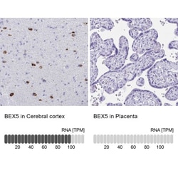 BEX5 Antibody, Novus Biologicals 25 &mu;L, Unlabeled:Antibodies, Polyclonal